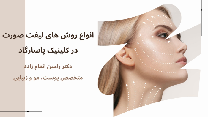 روش های لیفت صورت کلینیک پاسارگاد