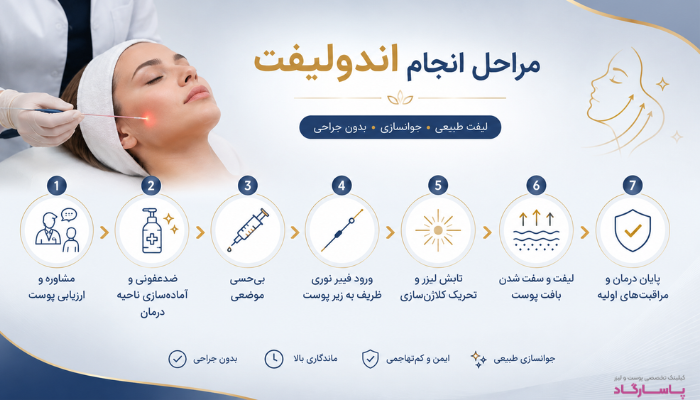 مراحل انجام اندولیفت