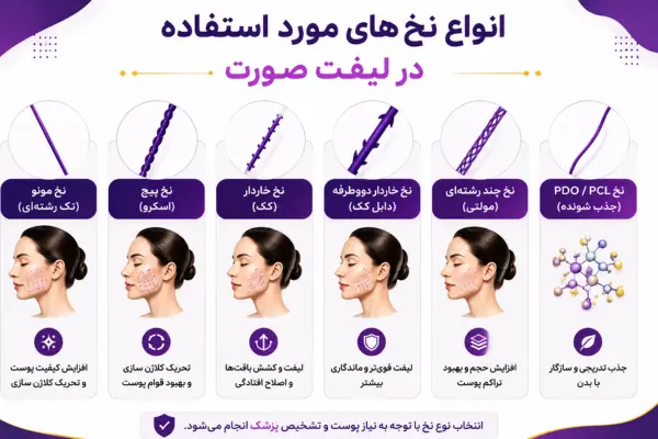 انواع نخهای مورد استفاده در لیفت صورت