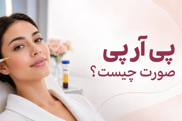 پی آر پی صورت چیست؟